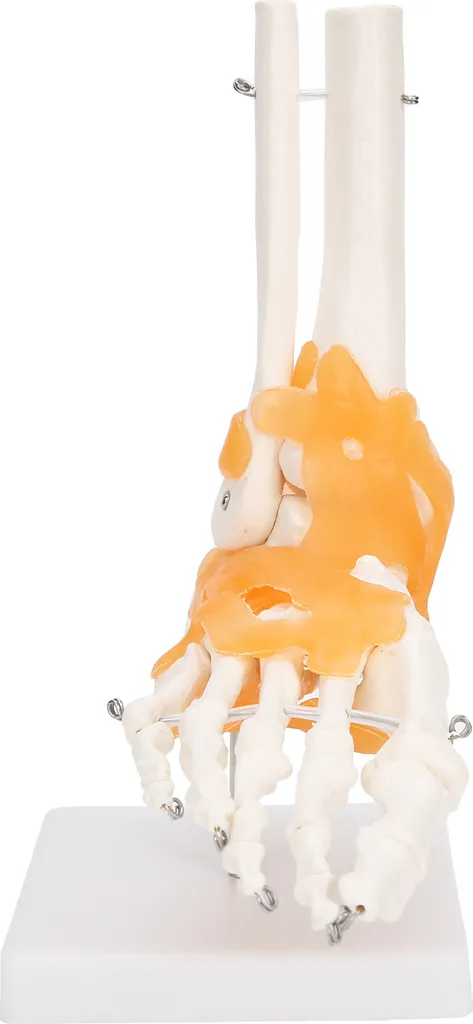 Modèle anatomique du pied 1:1 pour comprendre les lésions osseuses
