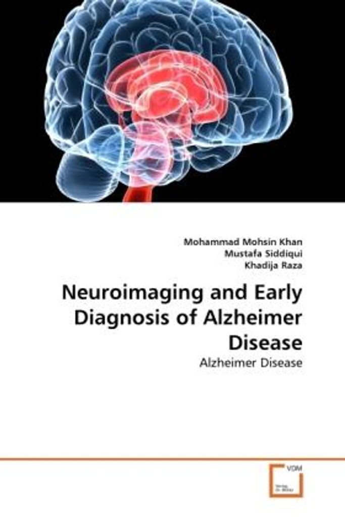 Mohsin Khan, M: Neuroimaging and Early Diagnosis of Alzheime