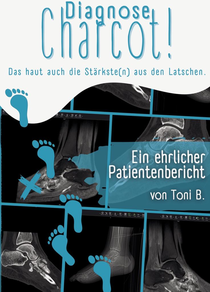 Diagnose Charcot!