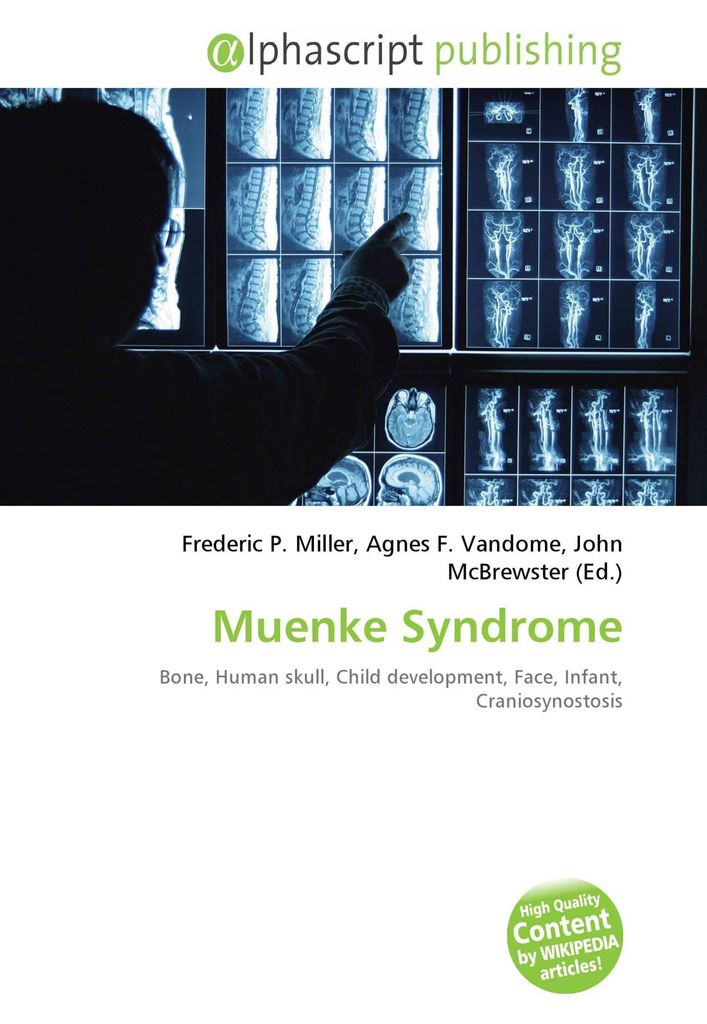 Muenke Syndrome