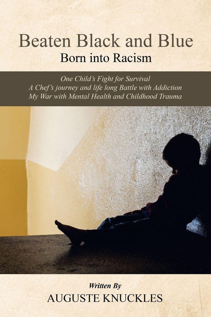Beaten Black And Blue: Born Into Racism – Lingua: Inglese