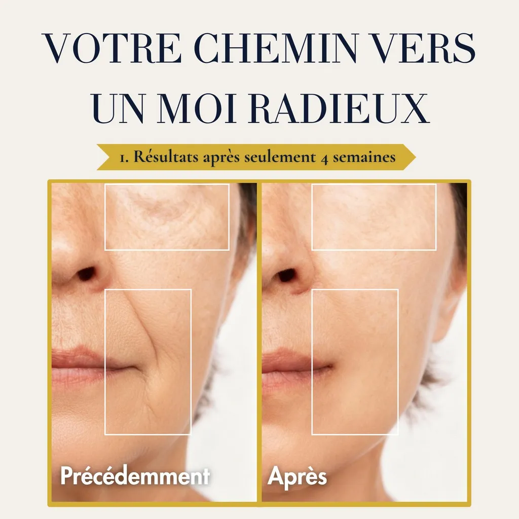 Winch Anti-Aging Miracle : Appareil de Luminothérapie TriGlow [New]