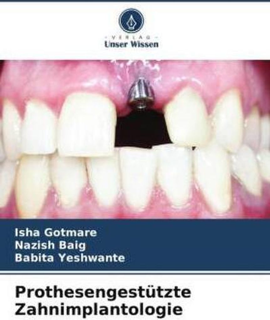 Prothesengestützte Zahnimplantologie