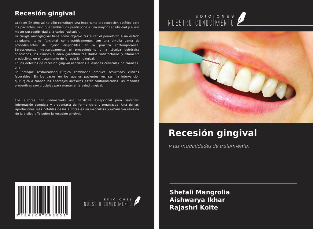 Recesión gingival