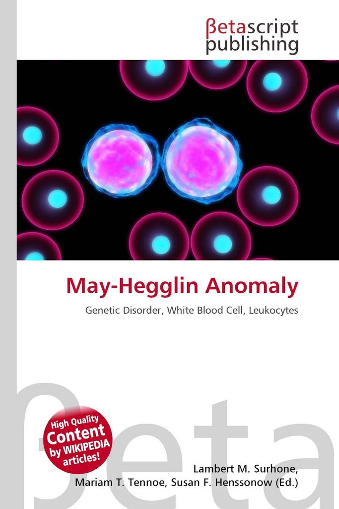 May-Hegglin Anomaly