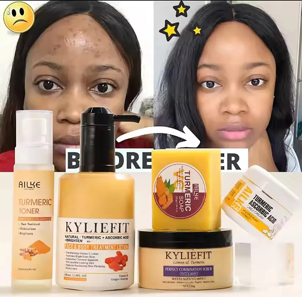 Ailke Turmeric Skin Care Set: Glow Up Anti-Macchie e Acne