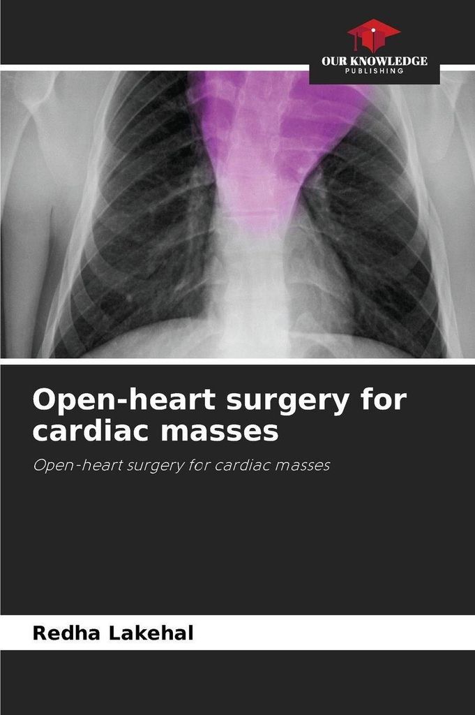Open-heart surgery for cardiac masses