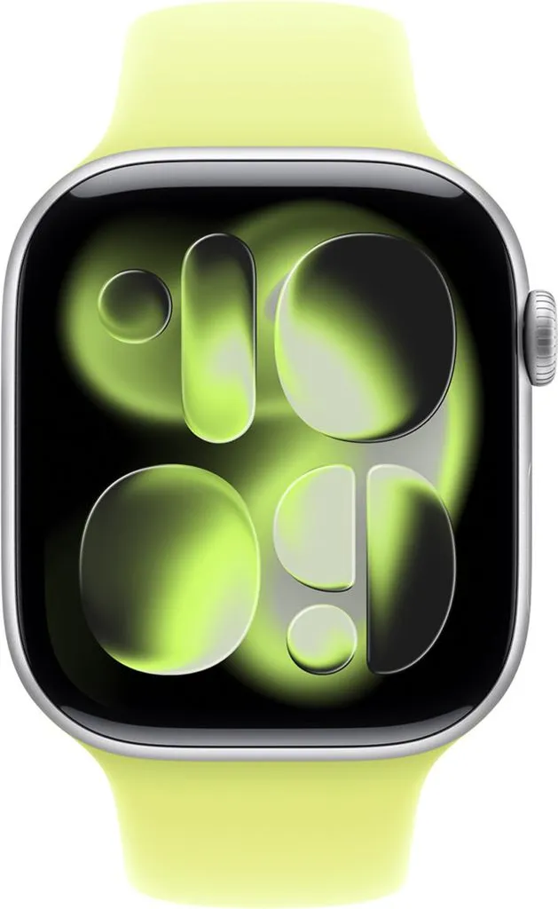 Apple MFGW4ZM/A accessorio indossabile intelligente Band Giallo Fluoroelastomero - 3