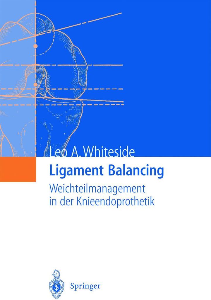 Ligament Balancing