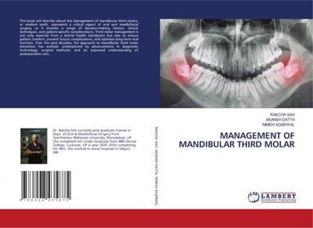 Management Of Mandibular Third Molar