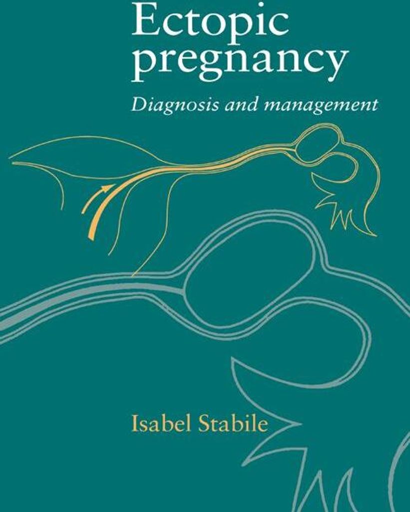 Ectopic Pregnancy