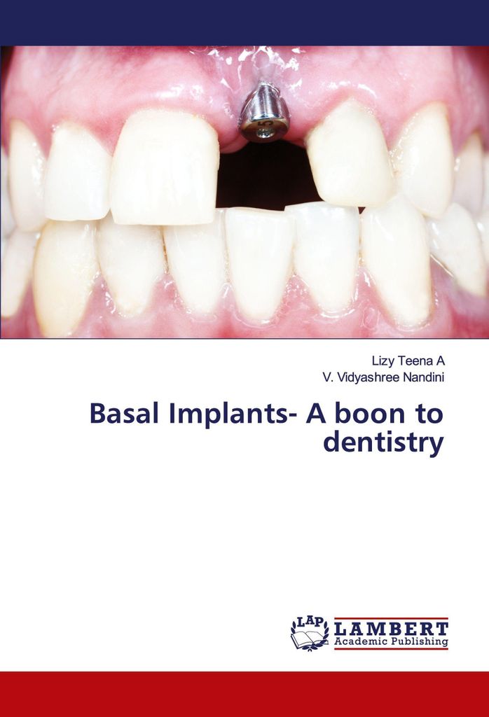 Basal Implants- A boon to dentistry