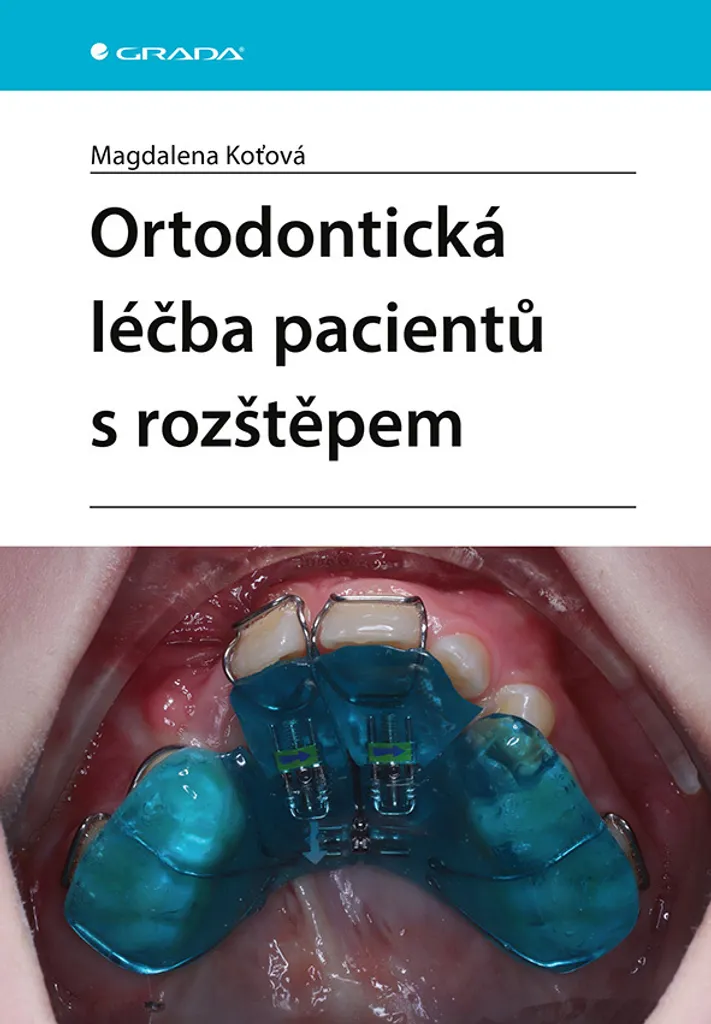 Comment traiter les fentes labio-palatines en orthodontie spécialisée