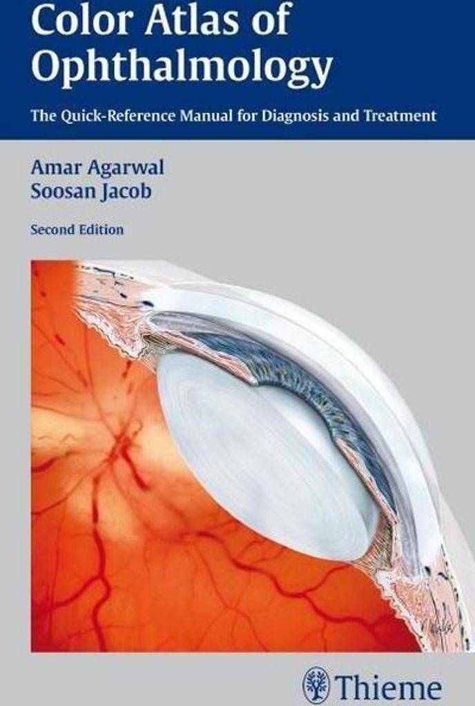 Color Atlas of Ophthalmology