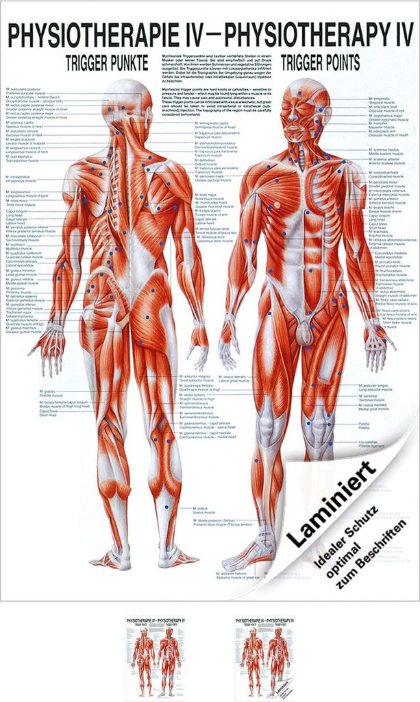 Triggerpunkte Poster Anatomie 70x50 cm medizinische Lehrmittel