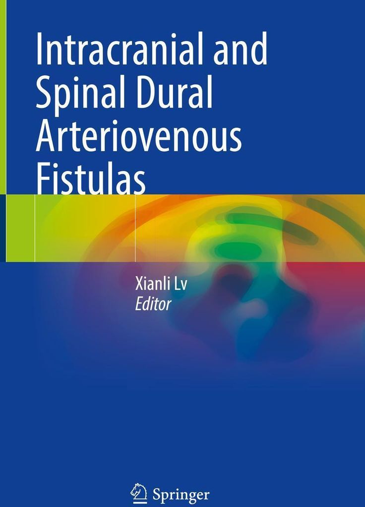 Intracranial and Spinal Dural Arteriovenous Fistulas