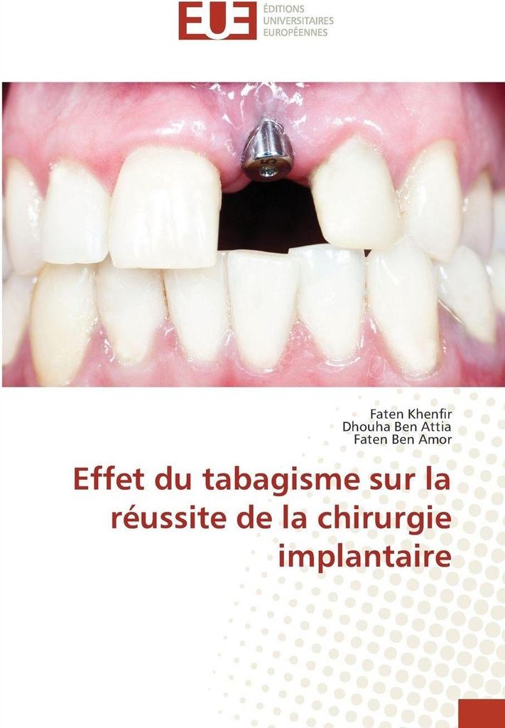Effet du tabagisme sur la réussite de la chirurgie implantaire