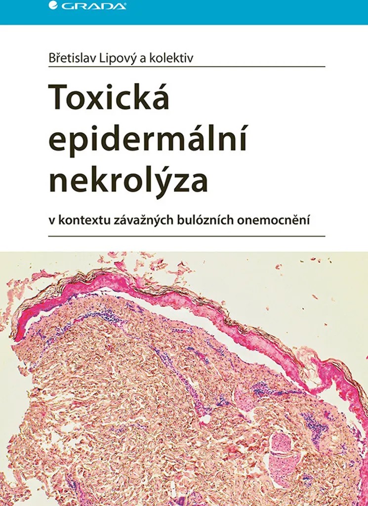 Livre de Dermatologie : Toxická Epidermální Nekrolýza de Břetislav Lipový