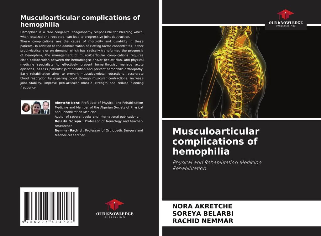 Musculoarticular complications of hemophilia