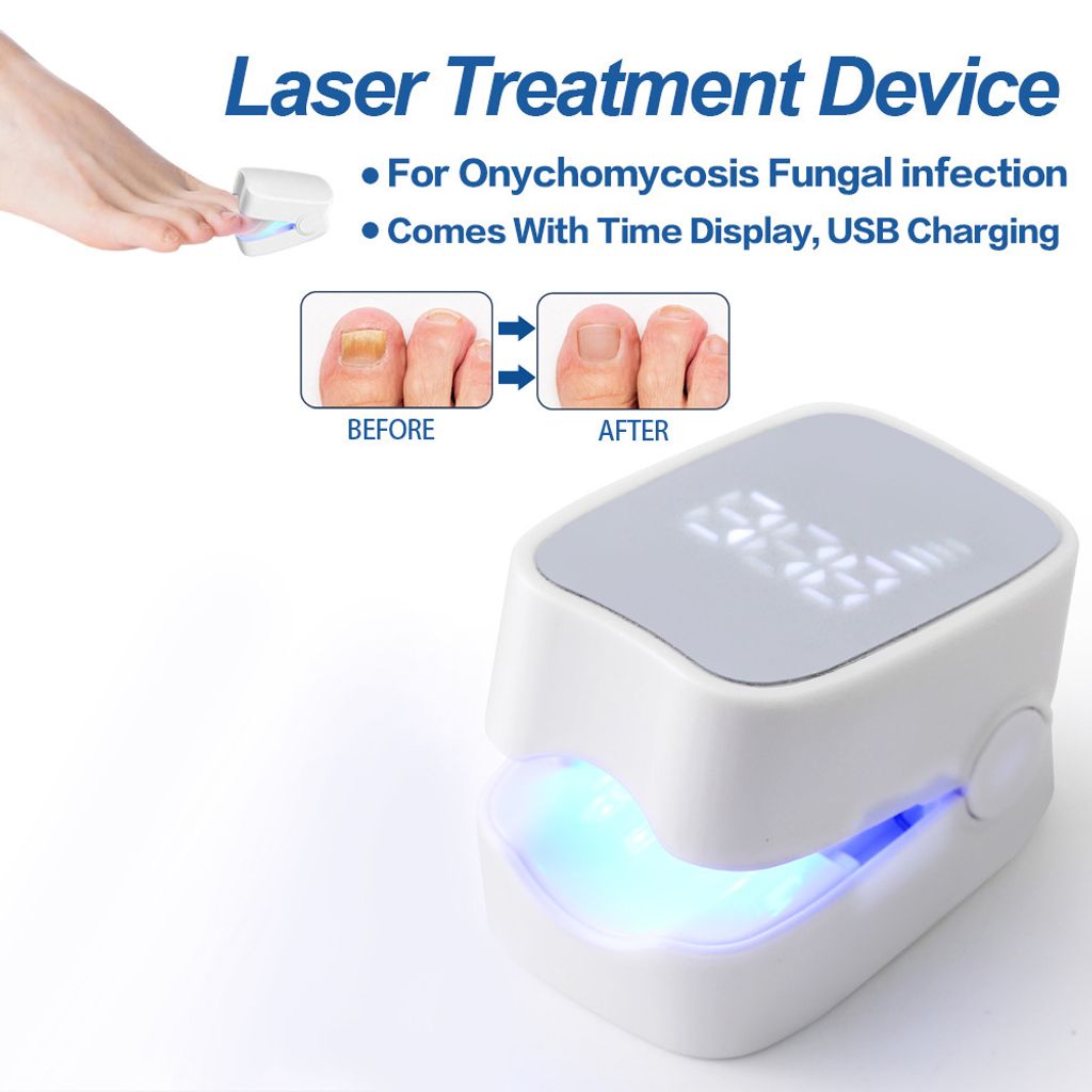 Lichthärtungsgerät Nagelpilz Laserbehandlungsgerät, Produktbild 6