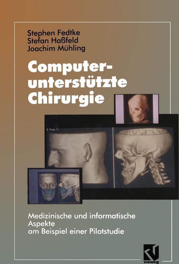 Computerunterstützte Chirurgie
