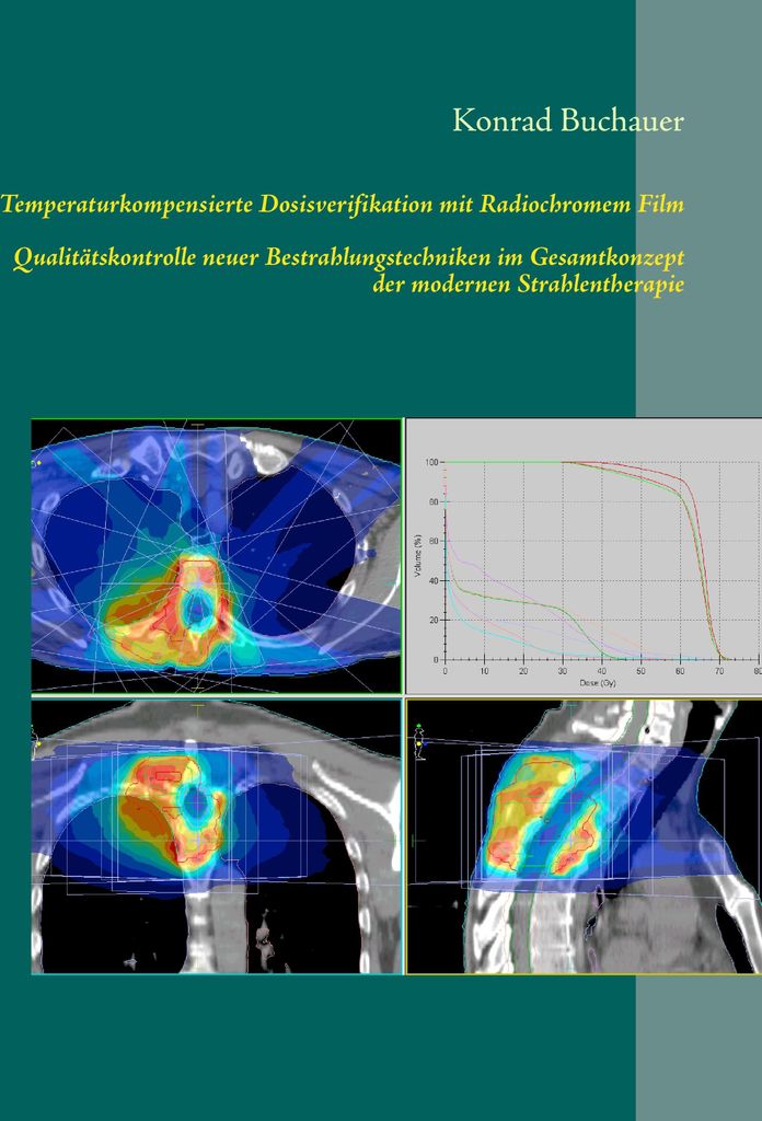 Temperaturkompensierte Dosisverifikation mit Radiochromem Film