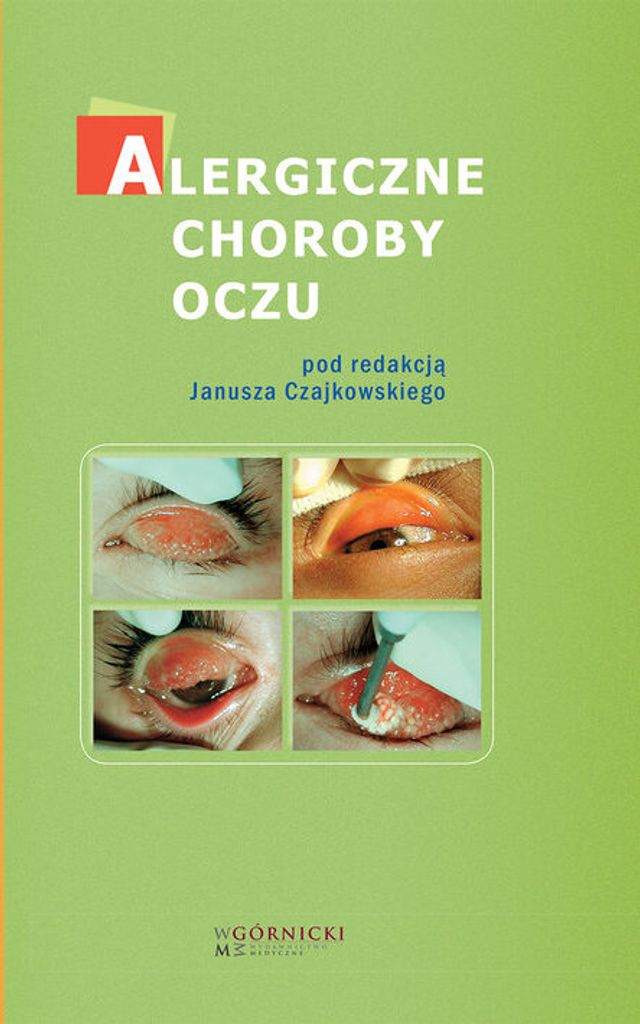 Alergiczne choroby oczu (Buch auf Polnisch)