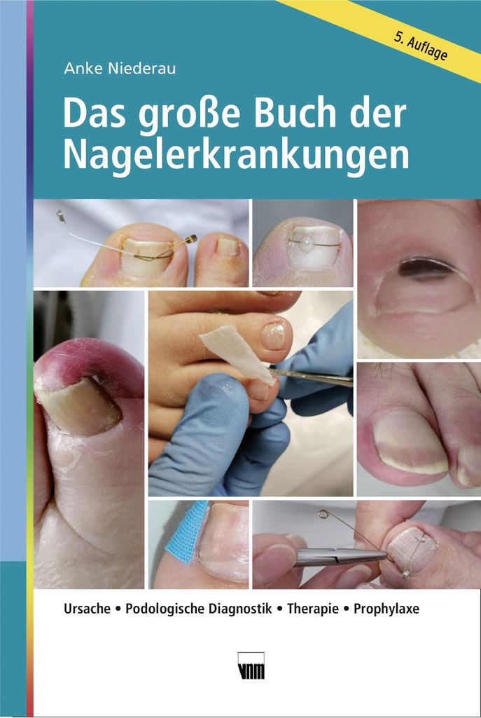 Das große Buch der Nagelerkrankungen Produktbild 