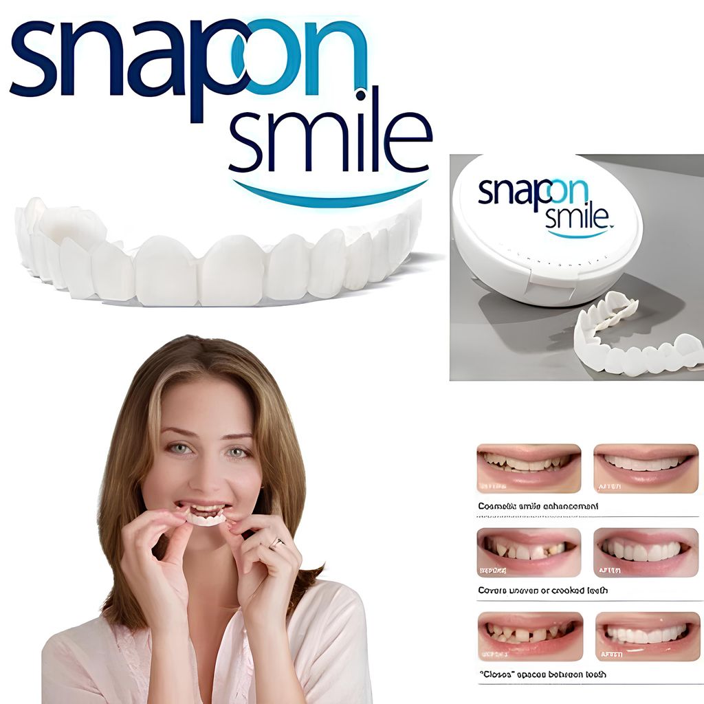 Zdejmowane licówki do zębów Snap On Smile zestaw góra i dół Zdjęcie produktu 