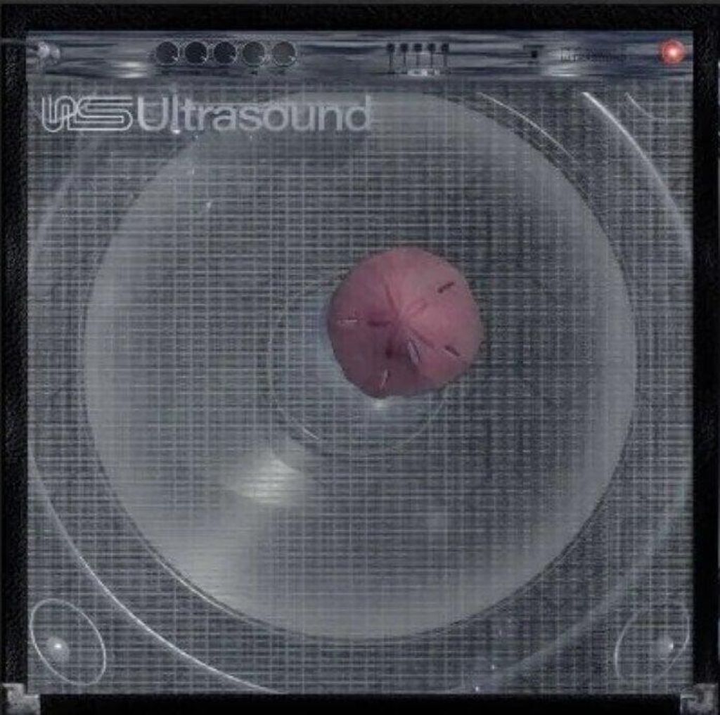 The Neighbourhood - Ultrasound + (Exclusivité Indie) Image du produit 