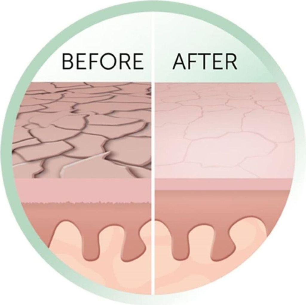 Mikrodermabrasion au diamant REVEAL Image du produit 