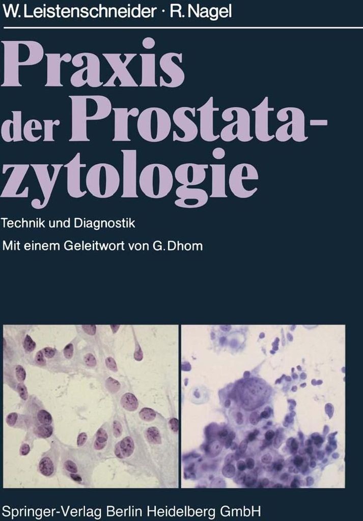 Praxis der Prostatazytologie