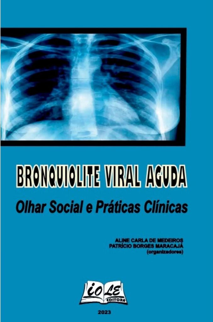 Bronquiolite Viral Aguda