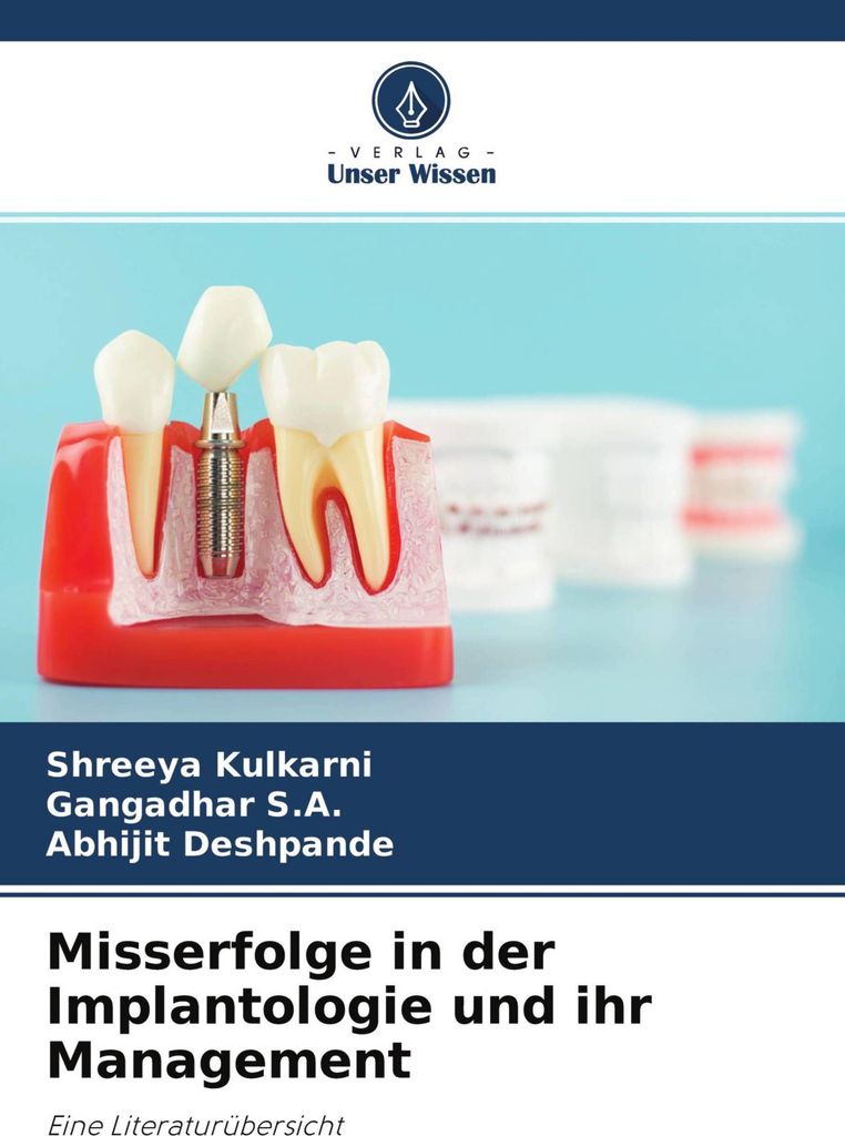 Misserfolge in der Implantologie und ihr Management