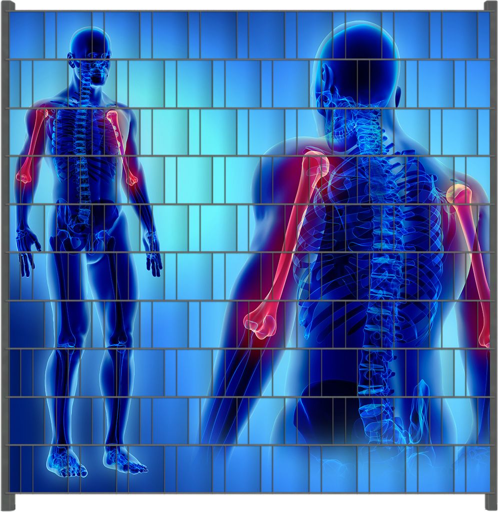 Wallario Zaunsichtschutz mit Motiv Anatomie Mensch Oberarmknochen für Ein- und Doppelstabmatten Zäune in der Größe 200 x 200 cm