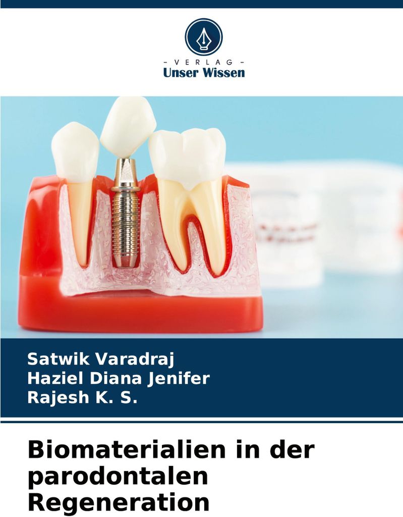 Biomaterialien in der parodontalen Regeneration