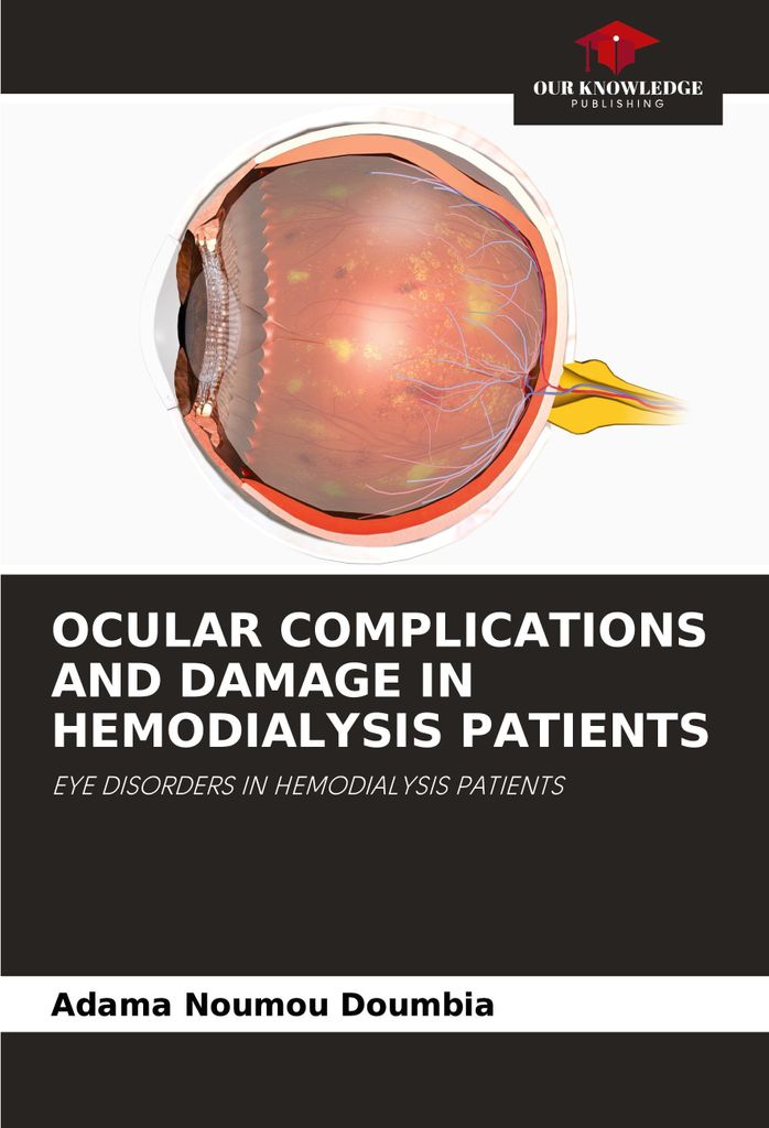 Ocular Complications And Damage In Hemodialysis Patients