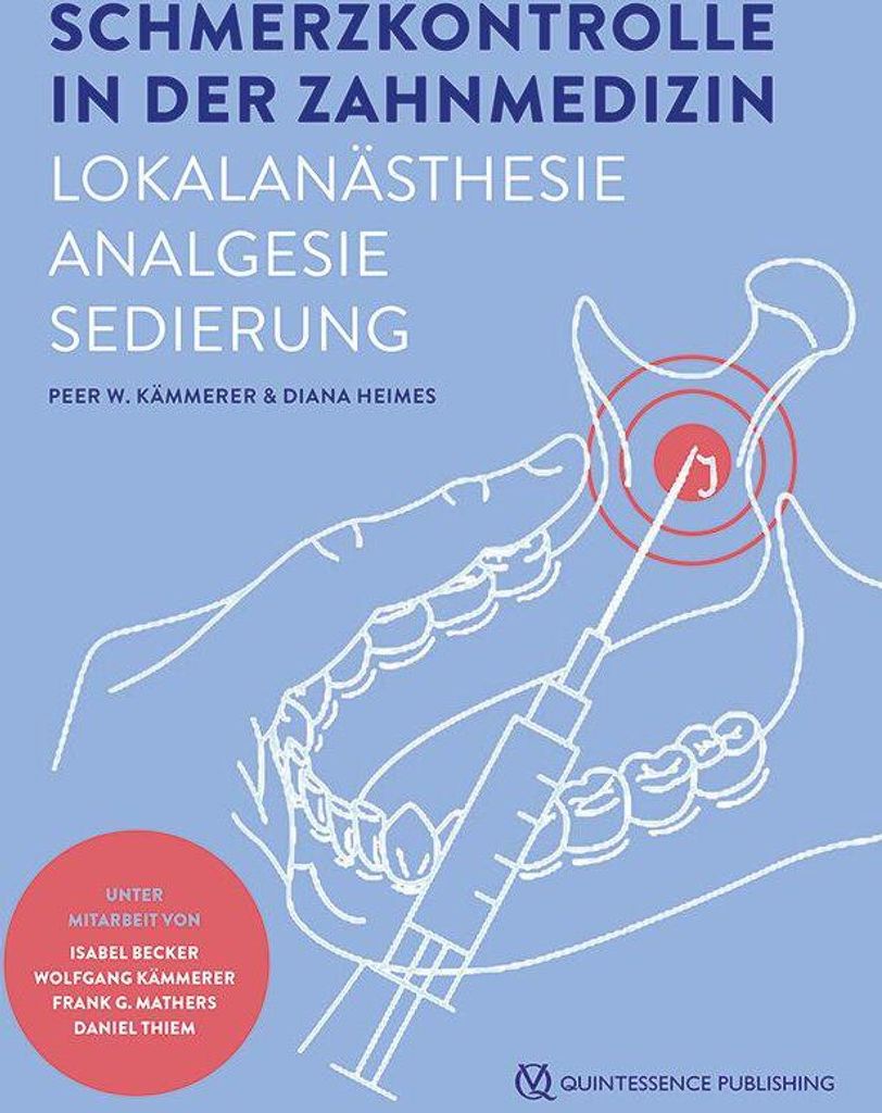 Schmerzkontrolle in der Zahnmedizin