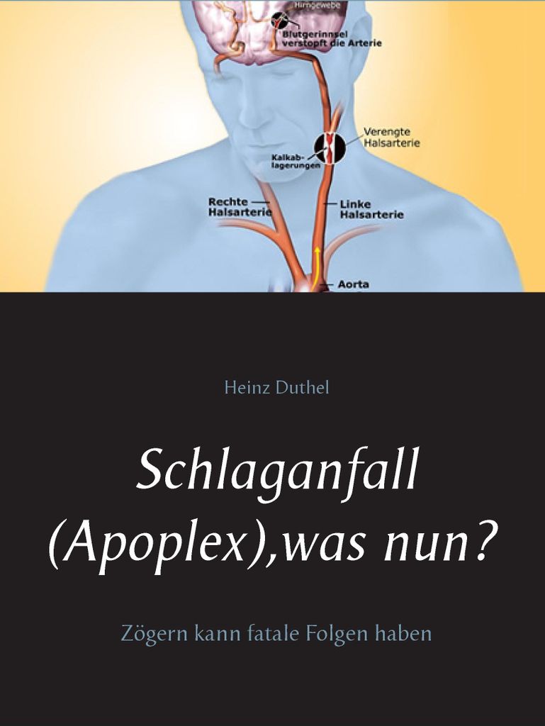Schlaganfall (Apoplex), was nun?