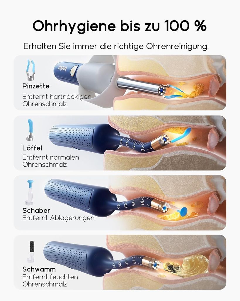 Bebird Ohrenschmalz Entferner Otoskop, 1920P HD Flexibler Produktbild 4