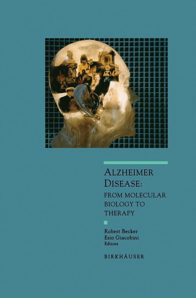 Alzheimer-Krankheit