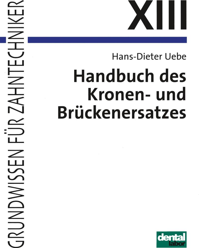Handbuch des Kronen- und Brückenersatzes