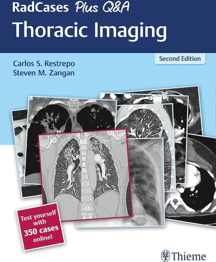 RadCases Plus Q&A Thoracic Imaging