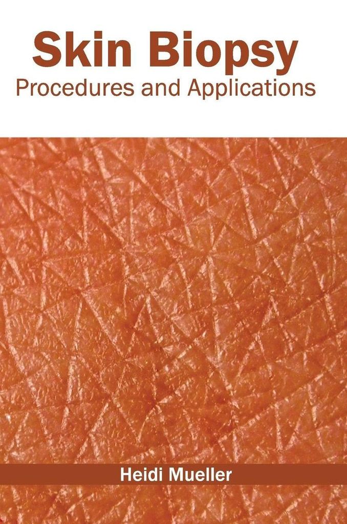Skin Biopsy