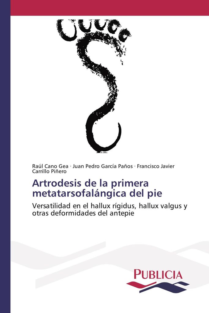 Artrodesis de la primera metatarsofalángica del pie