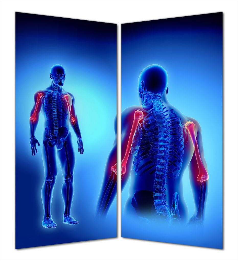 Wallario selbstklebende Duschrückwand 160 x 200 cm mit Motiv Anatomie Mensch Oberarmknochen - Wandverkleidung mit Hochglanzlaminat in Glasoptik