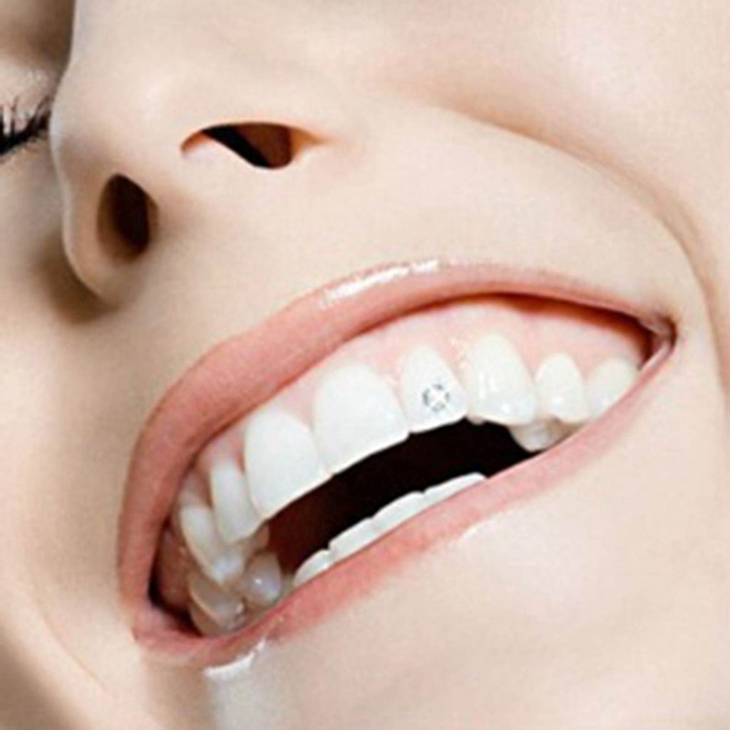 10 Stück Blau Oral Zähne Edelsteine ​​Kristall Zahnschmuck Produktbild 4