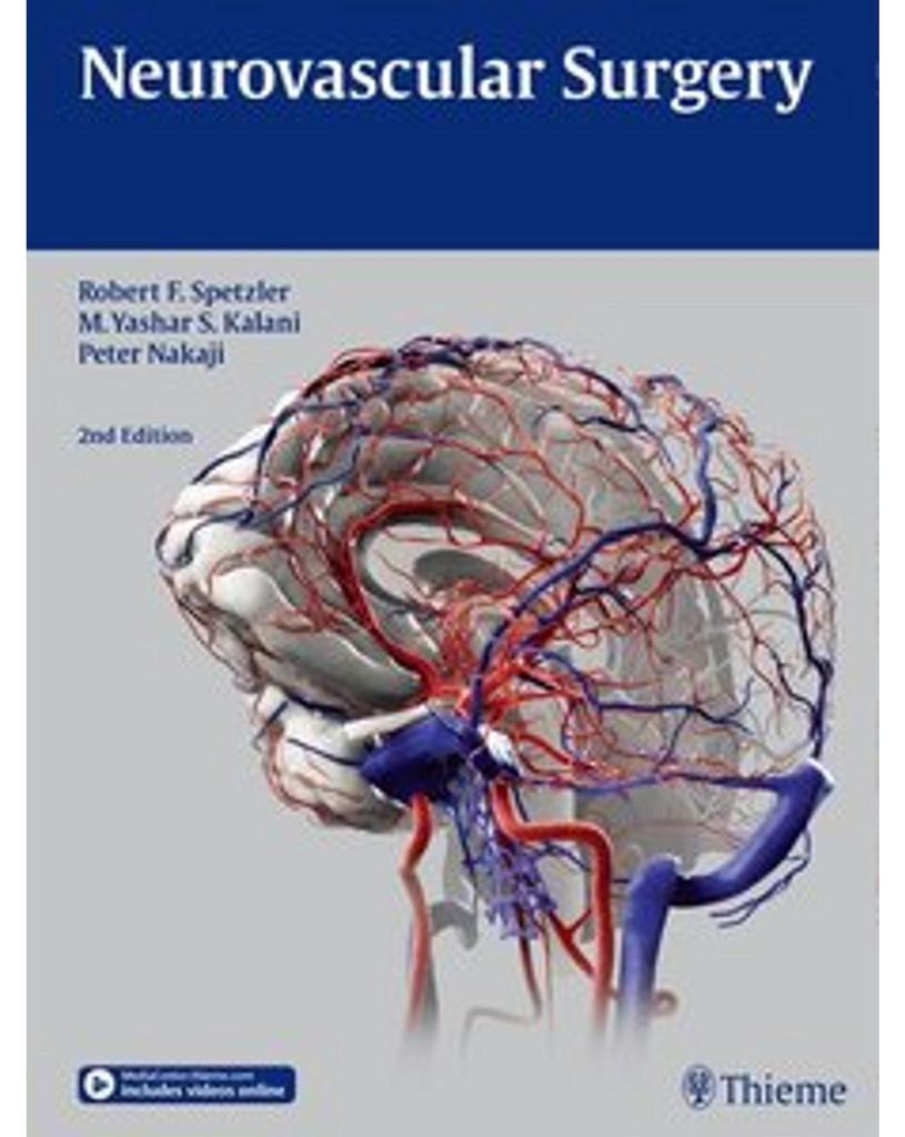 Neurovascular Surgery