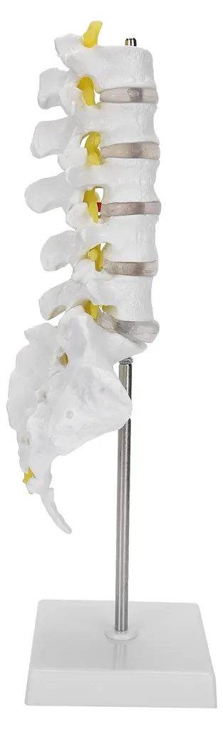 Modèle lombaire détaillé avec hernie discale pour démonstration médicale