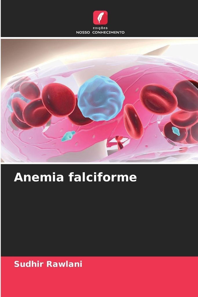 Anemia falciforme